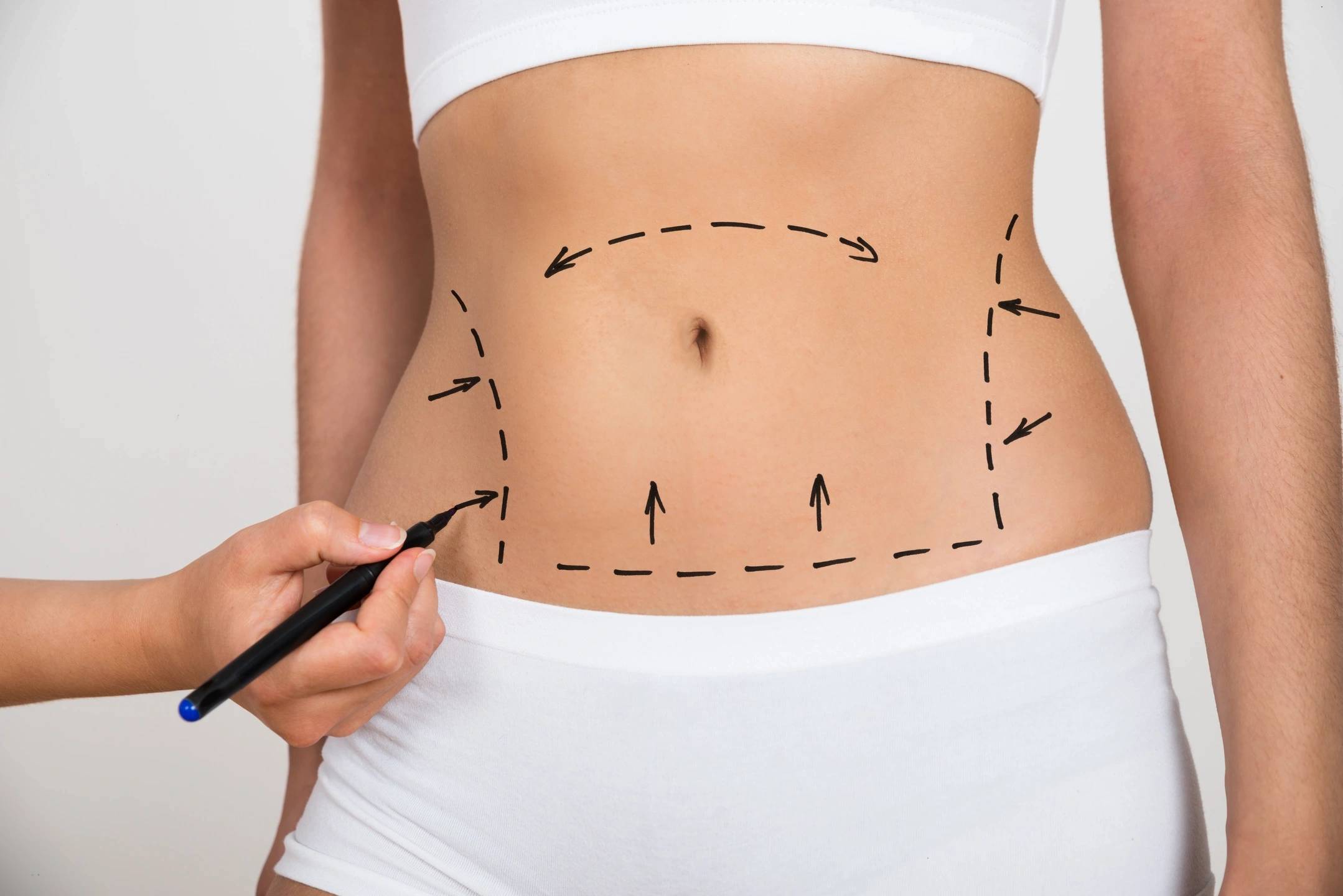 Breast Contouring Surgery